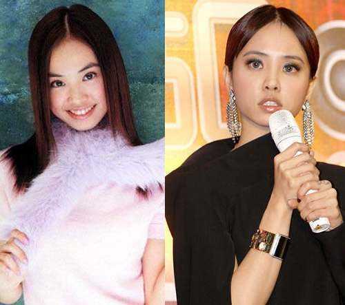 哪些明星做过肚脐整容,追求完美曲线的美丽秘密