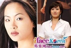 做过整容鉴定的明星